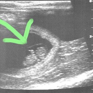 Ultraschallbild (ein Kitten von Coco) 25er Tag